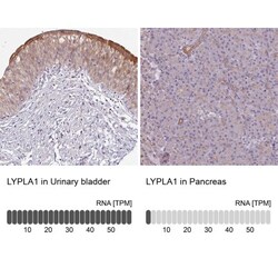 LYPLA1 Antibody, Novus Biologicals 0.1mL; Unlabeled:Antibodies, Polyclonal
